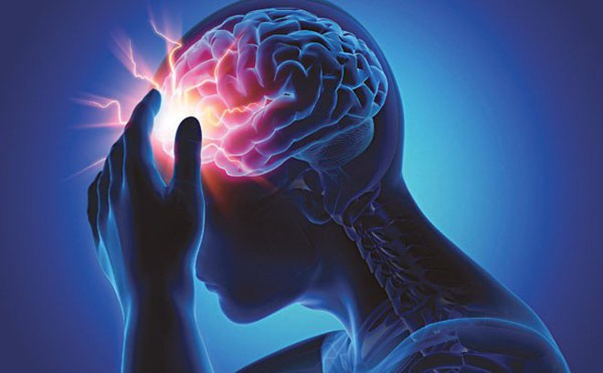 Dự đoán và cách phòng tránh bệnh tai biến mạch máu não